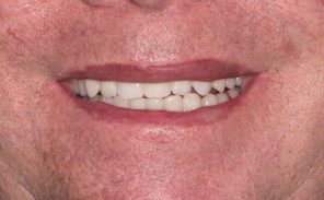 After - Wiltondental