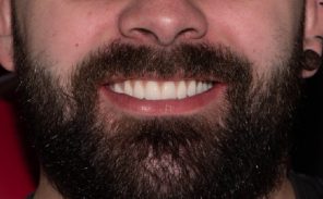 After - Wiltondental