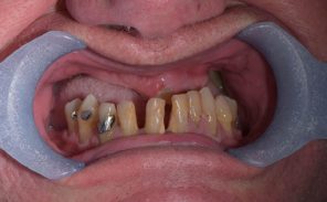 Before - Wiltondental