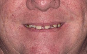 Before - Wiltondental